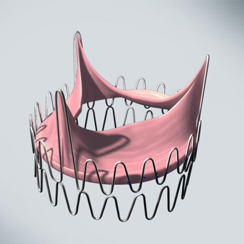 Heart Valve Prototype Concept