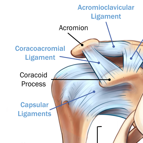 AC Joint Separation
