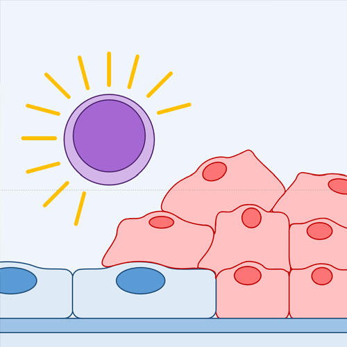 Immune Response to Tumor Cells